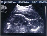 Kaija's very first picture ever!
