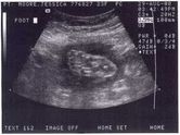 Baby foot
