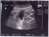 It's a girl!!!