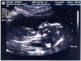 Filename=2000-06-23-first-ultrasound-profile03.jpg
Filesize=29KiB
Dimensions=483x367
Date added=May 01, 2005 2000-06-23-first-ultrasound-profile03.jpg
