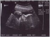 2000-08-29-second-ultrasound-face01.jpg