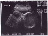 2000-08-29-second-ultrasound-face02.jpg