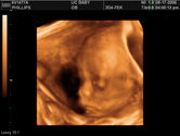 2006-08-17-3d-ultrasound-05.JPG