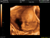 2006-08-17-3d-ultrasound-11.JPG