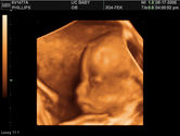 2006-08-17-3d-ultrasound-14.JPG