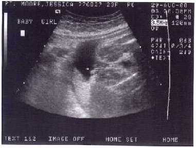 It's a girl!!!
