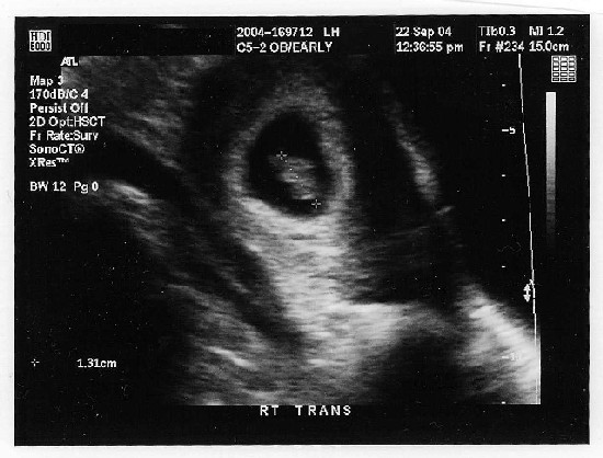Maddi's very first picture ever!
