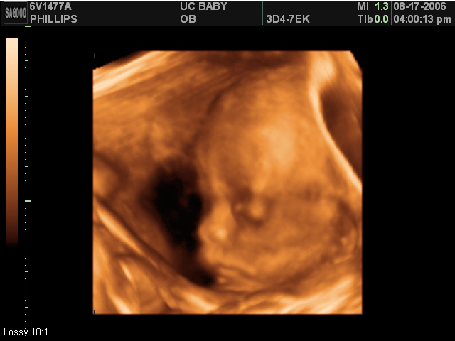 2006-08-17-3d-ultrasound-05.JPG