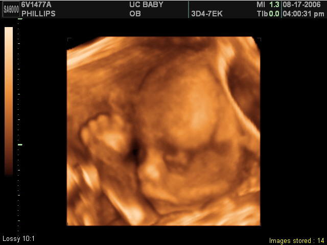 2006-08-17-3d-ultrasound-13.JPG