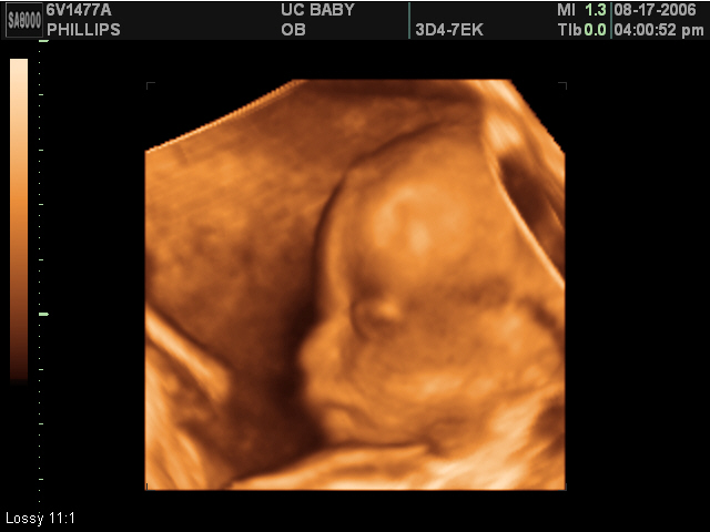 2006-08-17-3d-ultrasound-14.JPG