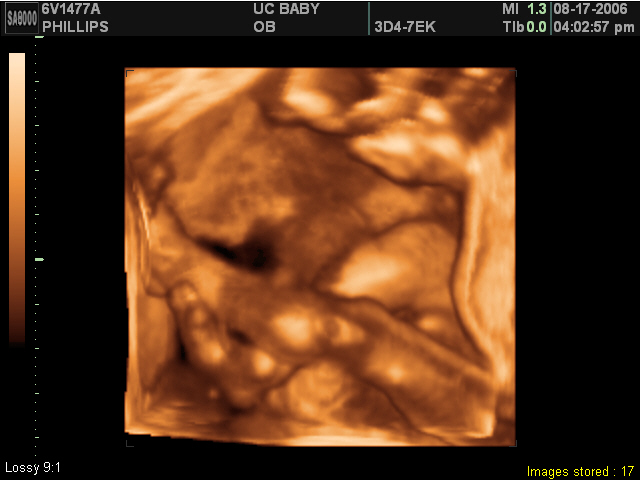 2006-08-17-3d-ultrasound-16.JPG