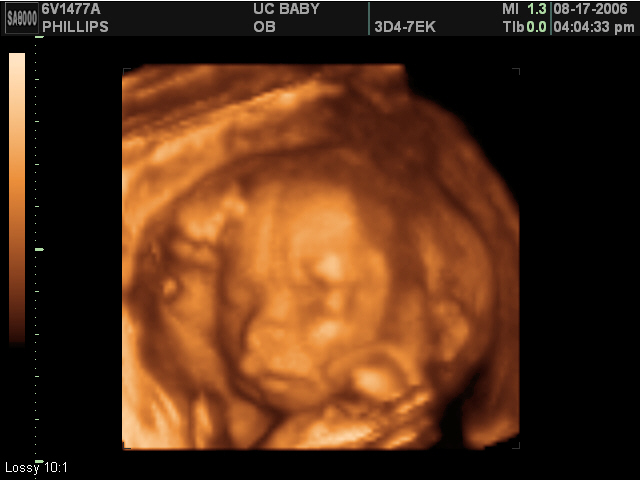 2006-08-17-3d-ultrasound-22.JPG