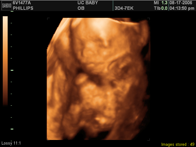 2006-08-17-3d-ultrasound-45.JPG