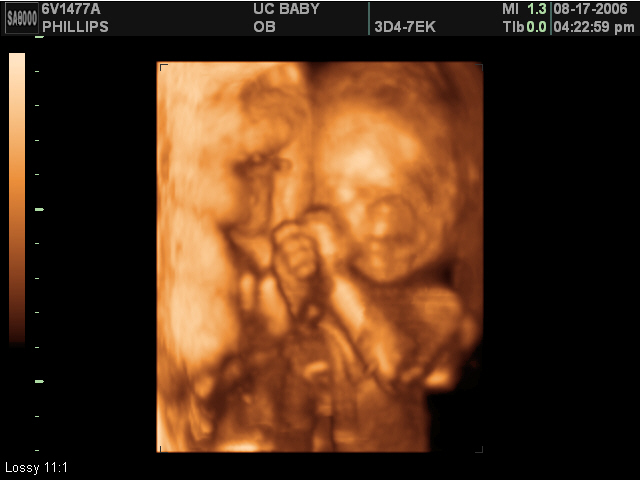 2006-08-17-3d-ultrasound-64.JPG