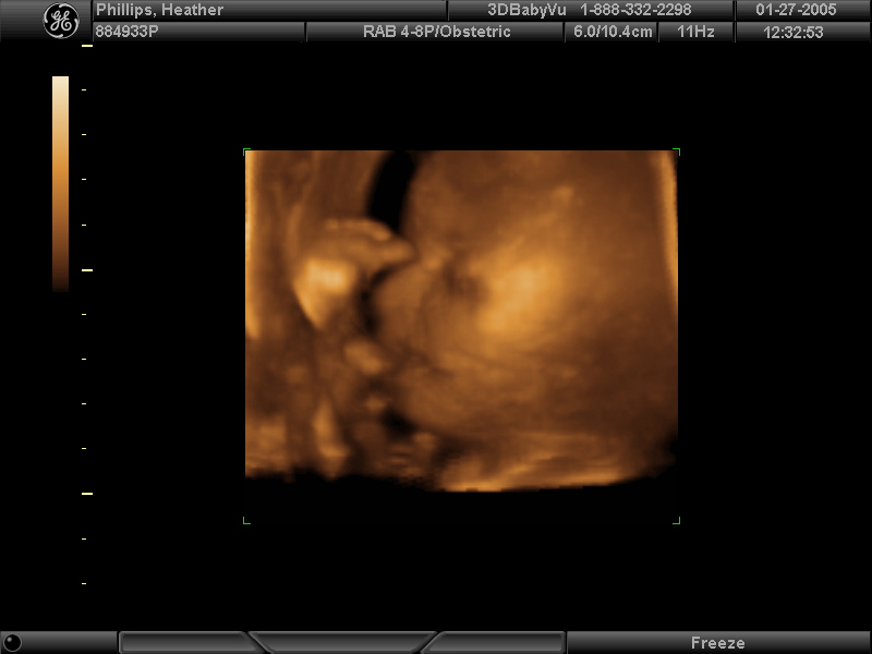 Maddi with her right foot in her eye
