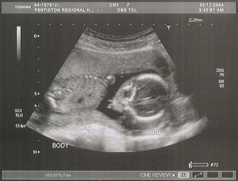 Even at 18 weeks she resembles her Daddy
