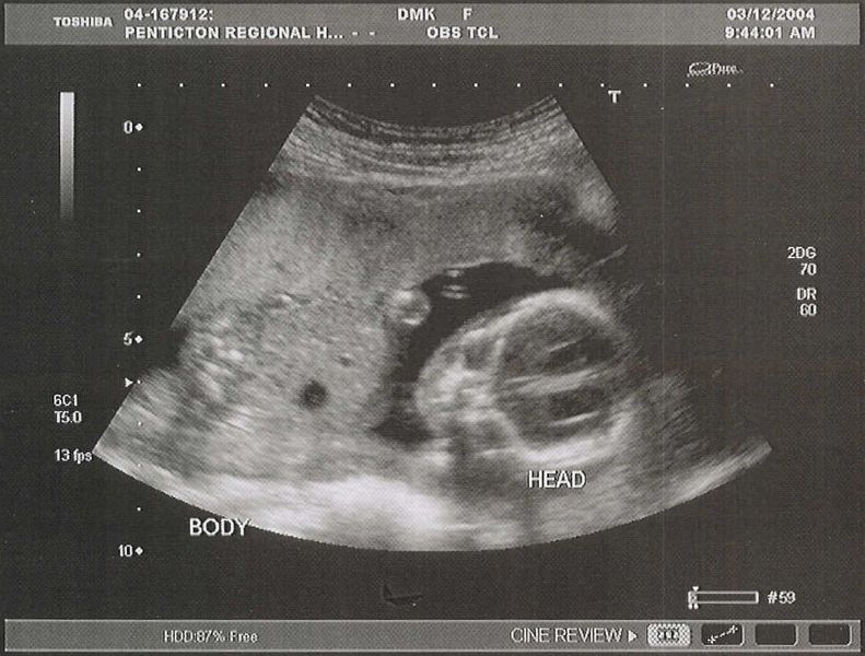 Maddi head on, and a possible hint of being a girl
