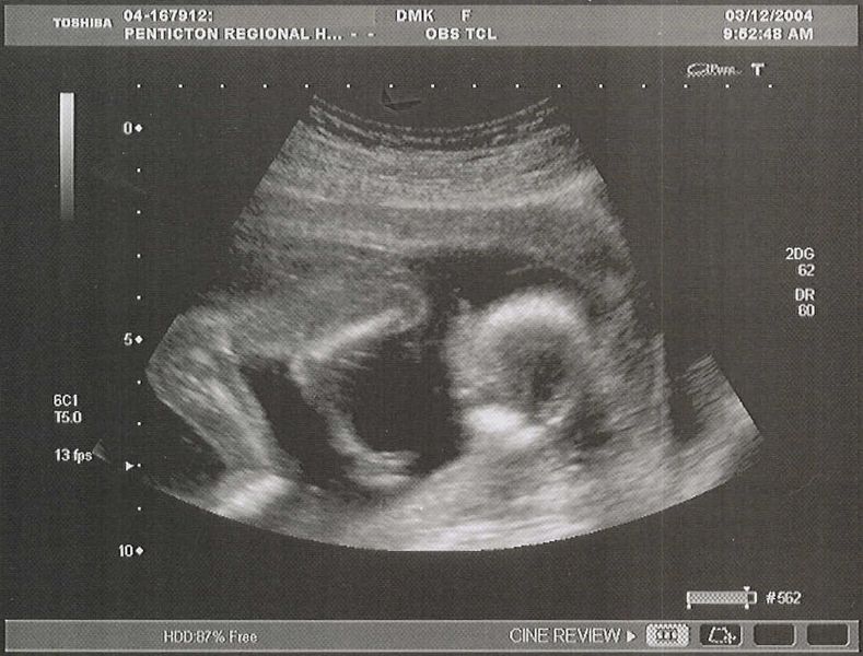 You can see her arm and legs bones in this one
