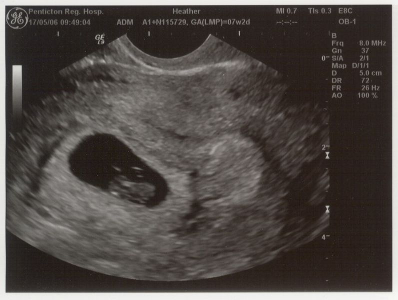 My first ever picture!
