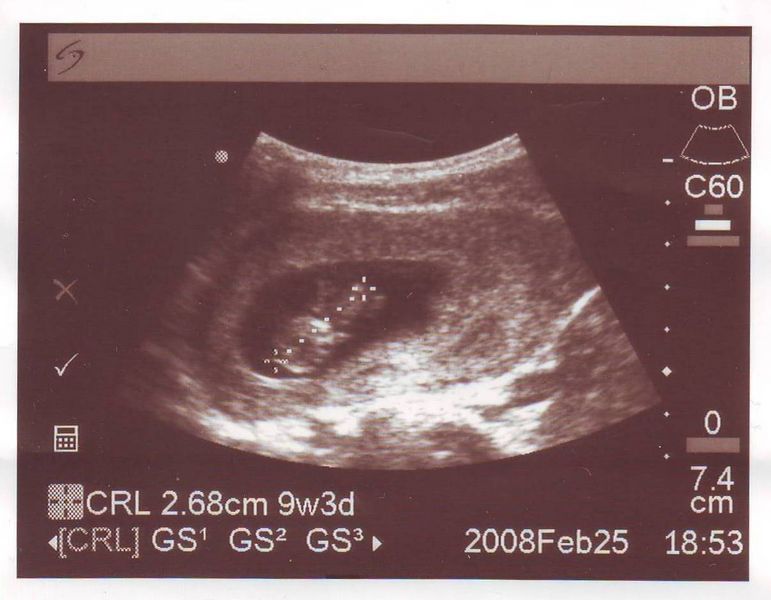 First ever picture
