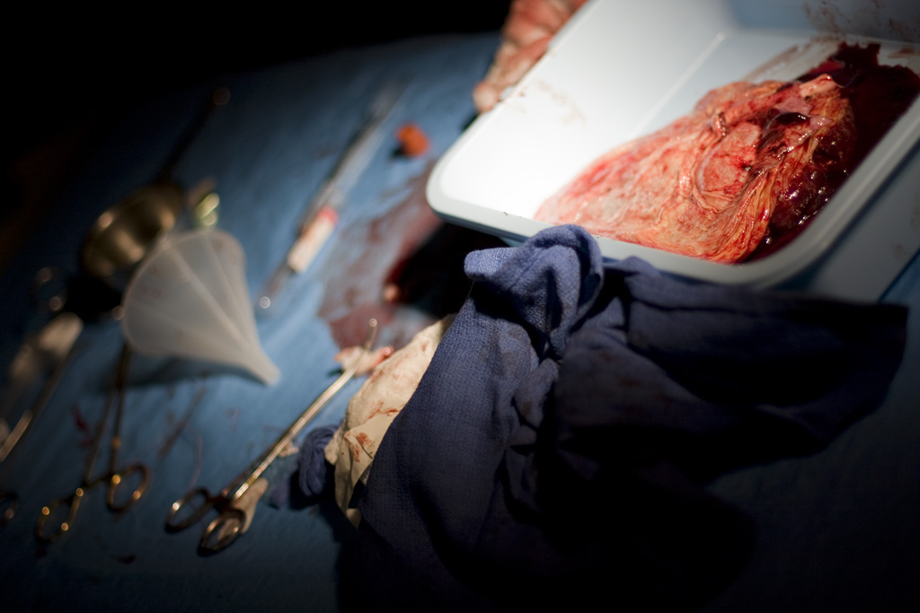 Placenta
