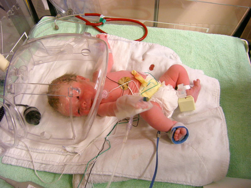 Poor guy, with all those tubes
