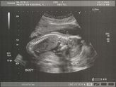 Filename=2004-12-03-ultrasound02.jpg
Filesize=234KiB
Dimensions=1087x825
Date added=Sep 05, 2005 2004-12-03-ultrasound02.jpg