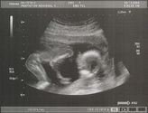 Filename=2004-12-03-ultrasound05.jpg
Filesize=230KiB
Dimensions=1085x825
Date added=Sep 05, 2005 2004-12-03-ultrasound05.jpg