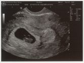 2006-05-17-ultrasound1.jpg