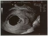 2006-05-17-ultrasound2.jpg