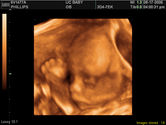 2006-08-17-3d-ultrasound-13.JPG
