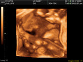 2006-08-17-3d-ultrasound-16.JPG