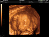 2006-08-17-3d-ultrasound-22.JPG