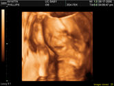 2006-08-17-3d-ultrasound-27.JPG