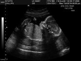 2006-08-17-3d-ultrasound-36.JPG