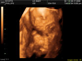2006-08-17-3d-ultrasound-45.JPG