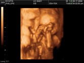 2006-08-17-3d-ultrasound-63.JPG
