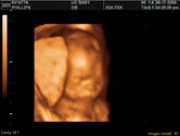 2006-08-17-3d-ultrasound-77.JPG