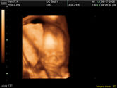 2006-08-17-3d-ultrasound-78.JPG