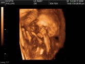 2006-08-17-3d-ultrasound-80.JPG