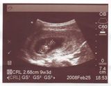 2008-02-27-ultrasound.JPG
